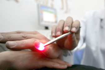 Laser acupuncture