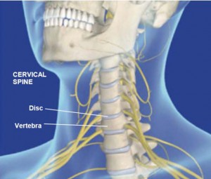 Cervical Spinal Stenosis