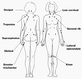 Natural Rheumatoid Arthritis Treatment by Dr. Mercola