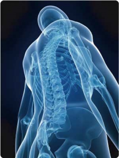 Ankylosing spondylitis