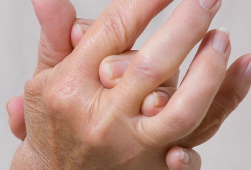 Certain Lifestyle Factors Linked to Arthritis