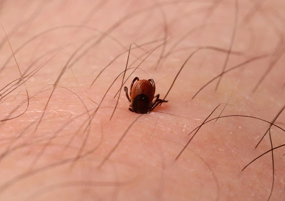 Child Arthritis Cases Spike as Lyme Disease Pushes Further into Canada